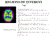 roi.gif (25358 bytes)