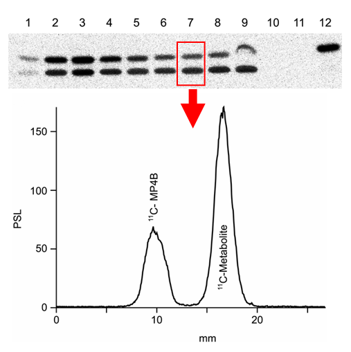 TLC chromatogram